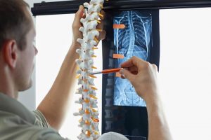 The Symptoms of Degenerative Disc Disease