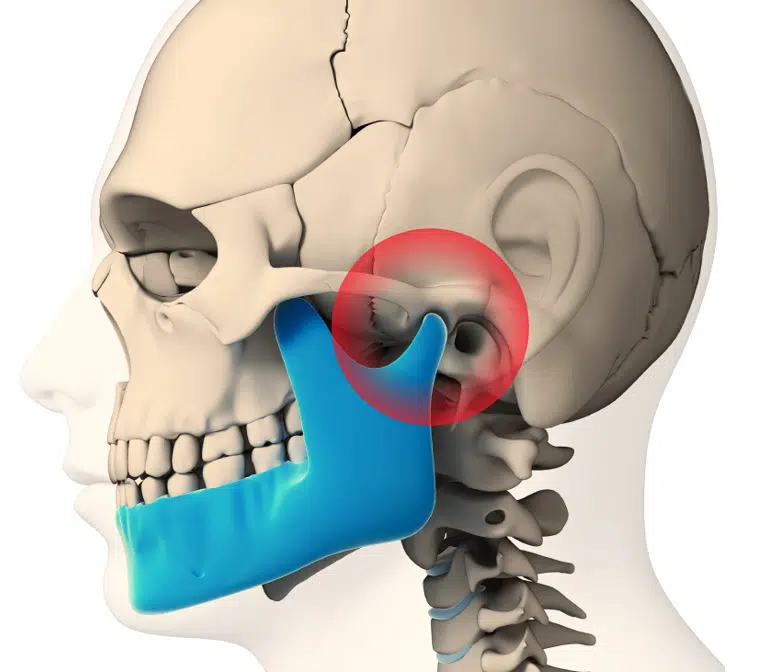 Graphical diagram of a skull with the jaw in blue color and the temporomandibular joint highlighted in red color