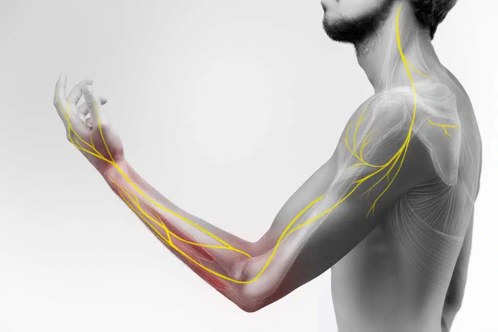 Illustration of the human arm anatomy representing nerves, bones and ligaments.