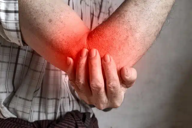 Man holding his elbow cause of severe pain in the elbow joint.
