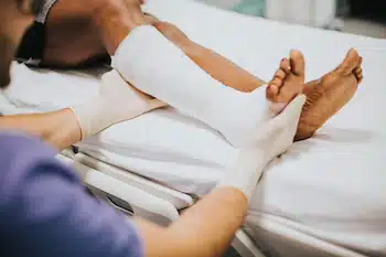 mans' leg with sprain bandage